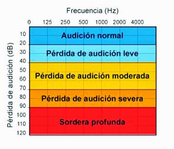 Frencuencia en Hz que evalúa una audiometría