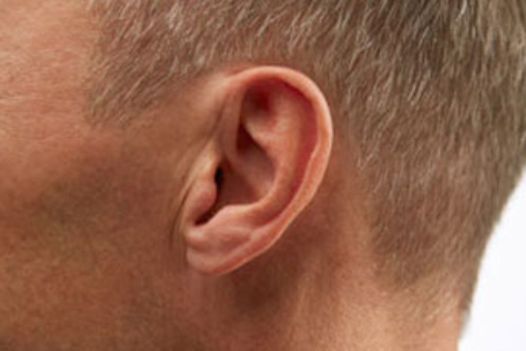 Malformación oído interno